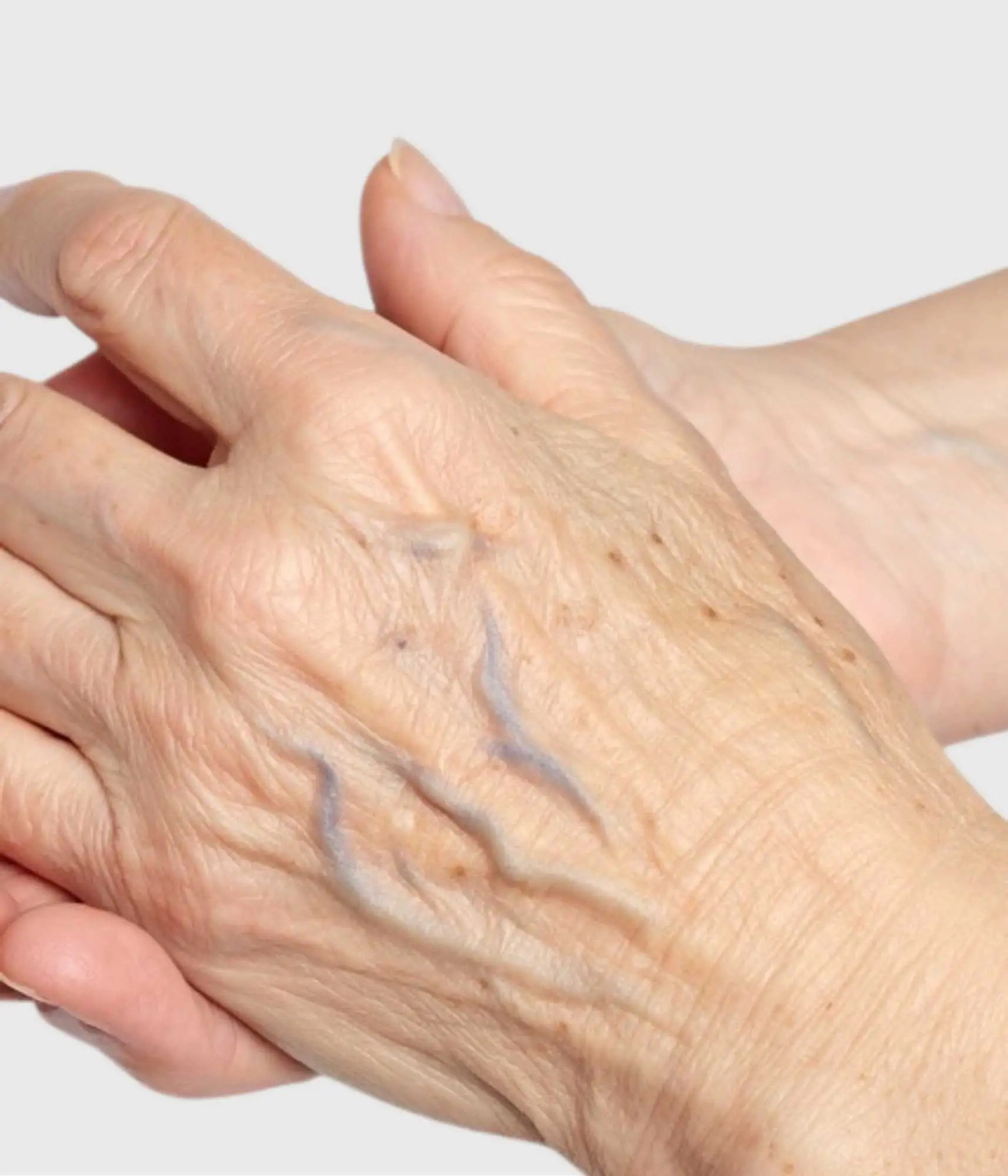 Hand Veins