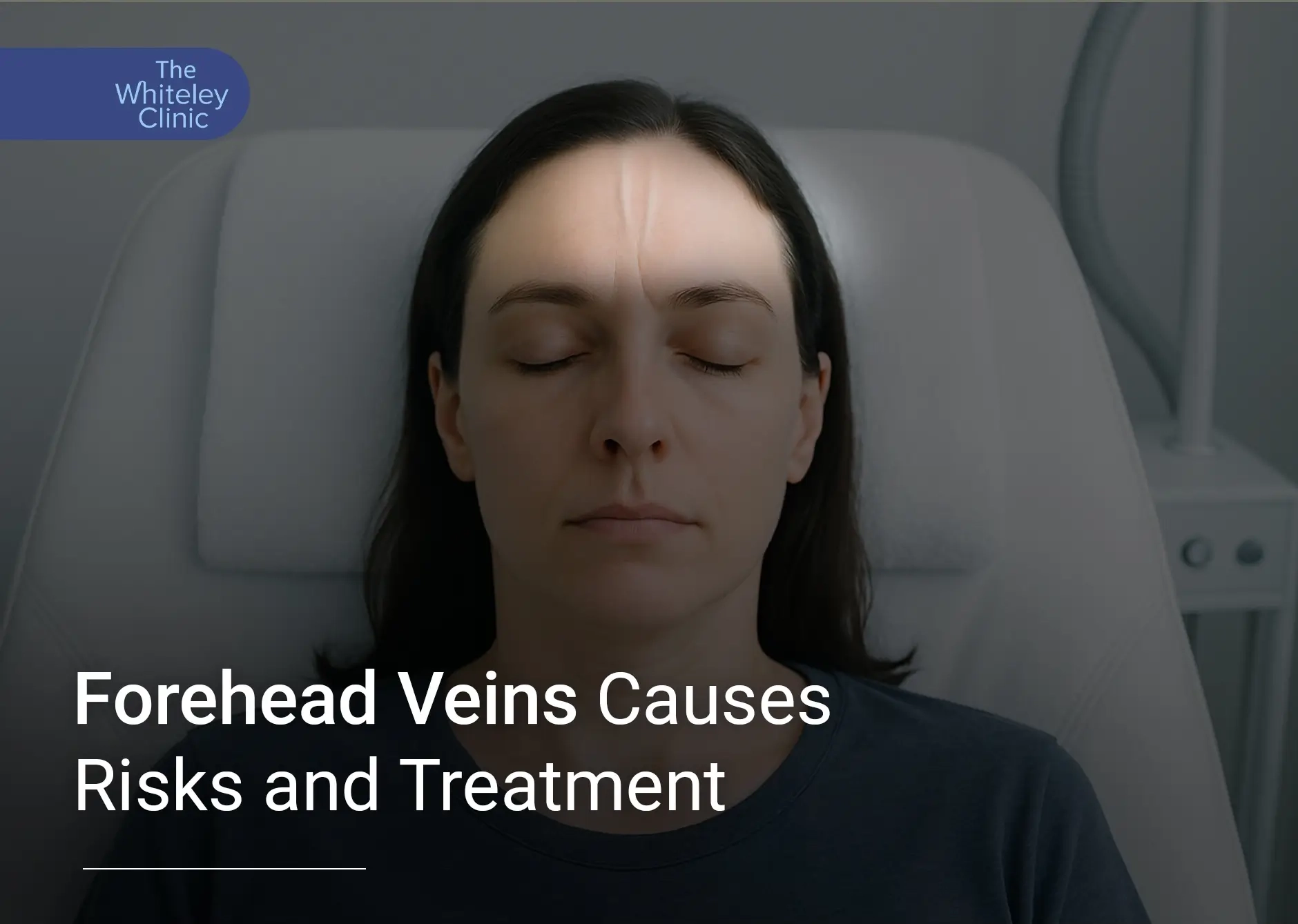 Forehead Veins Causes Risks and Treatment