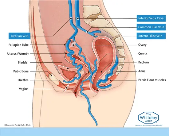 Diagram of the Female Pelvis