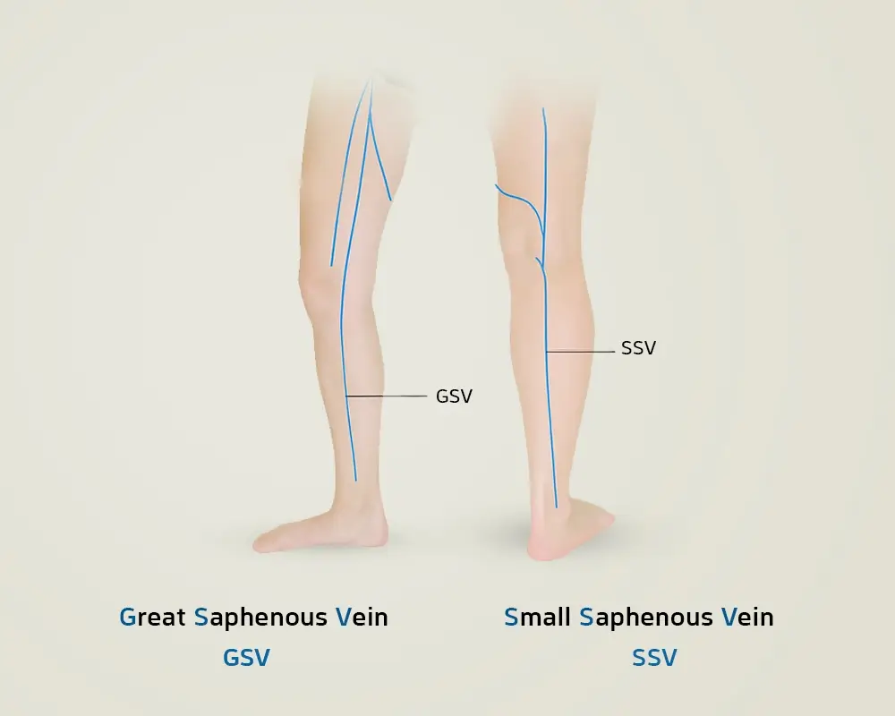great saphenous vein (GSV) and the small saphenous vein (SSV)