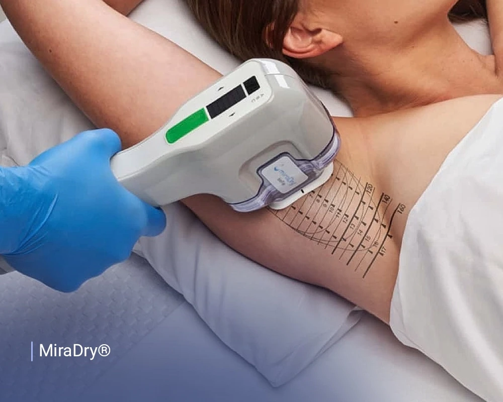 miraDry® at Absolute Aesthetics