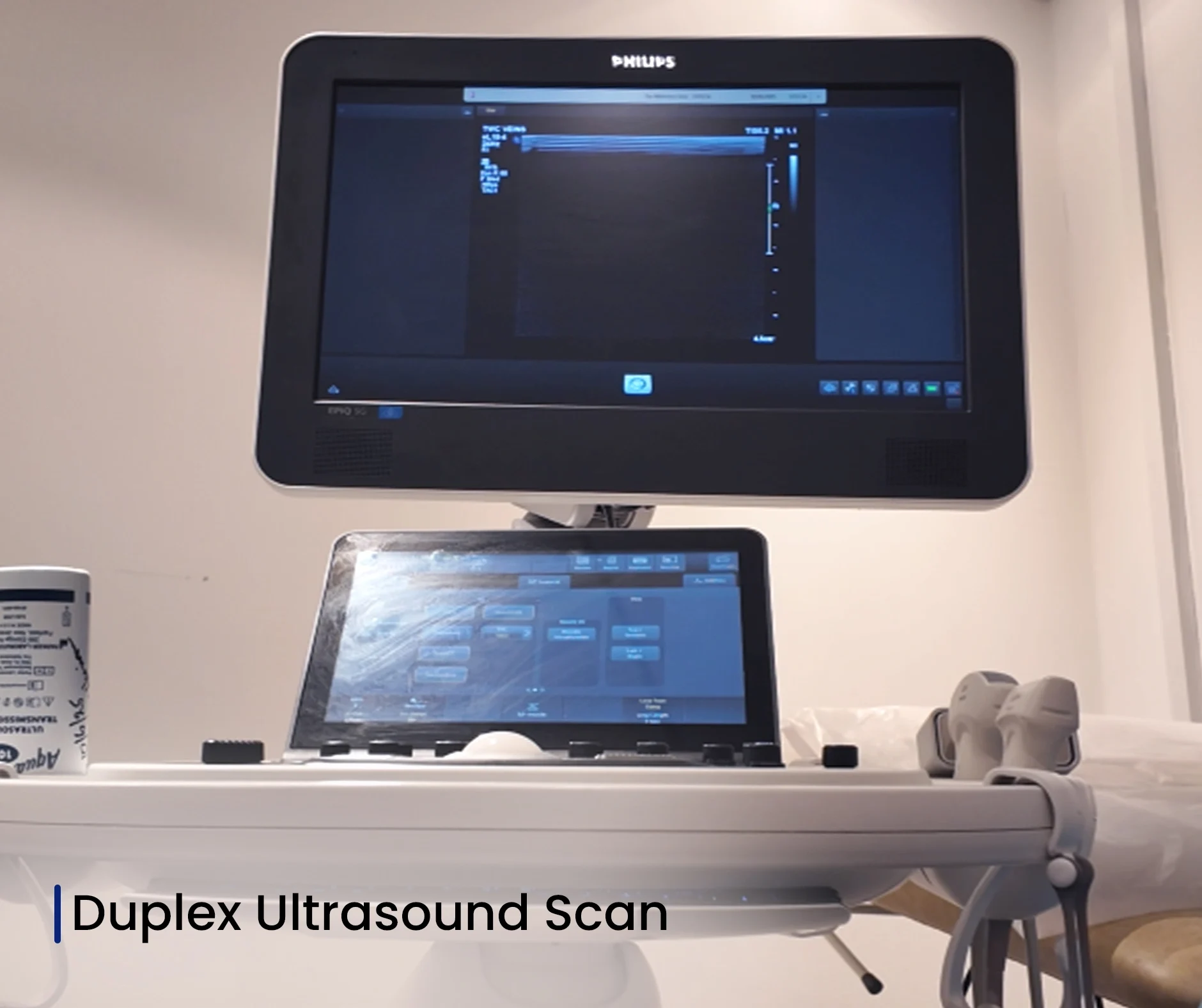 Duplex Ultrasound Scan