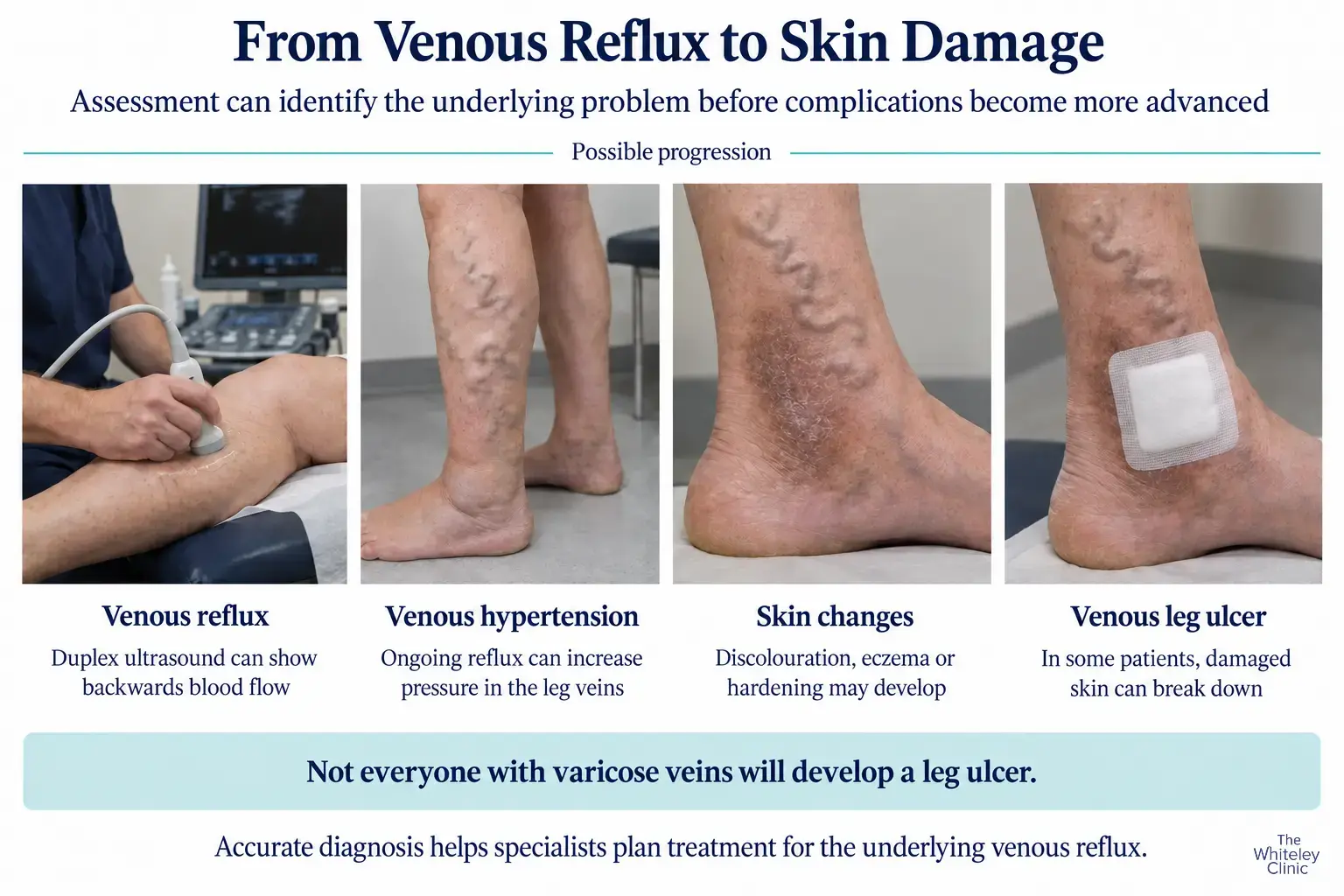 From Venous Reflux to Skin Damage