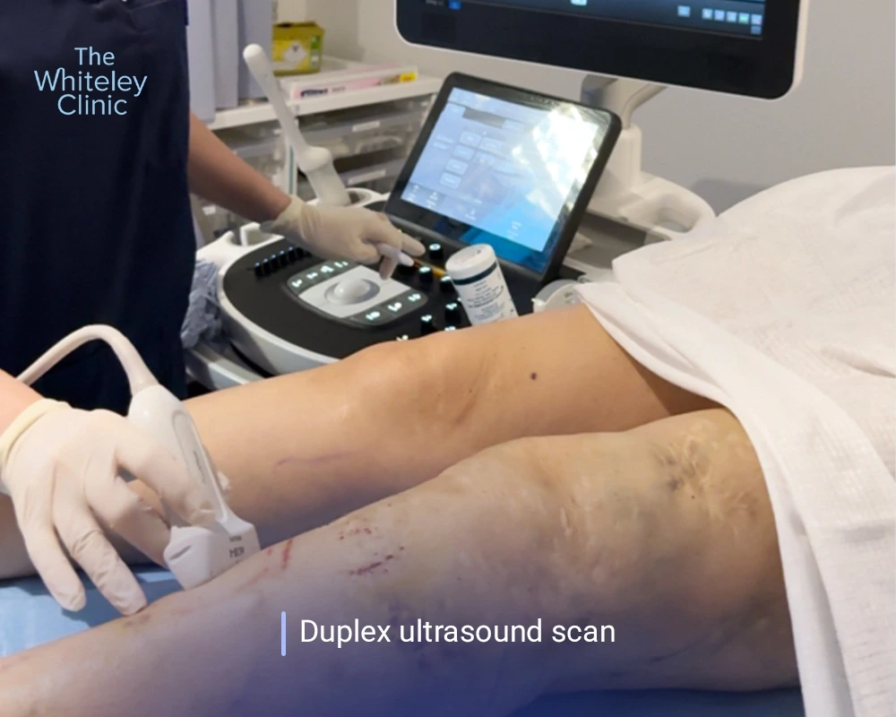 duplex ultrasound at The Whiteley Clinic
