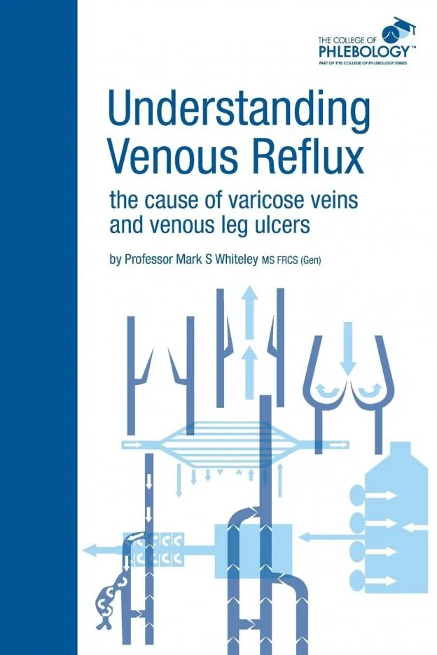 the cause of varicose veins and venous leg ulcers
