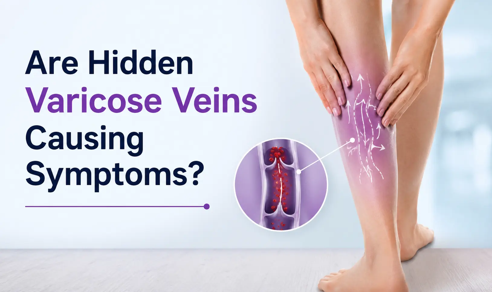 Are Hidden Varicose Veins Causing Symptoms?