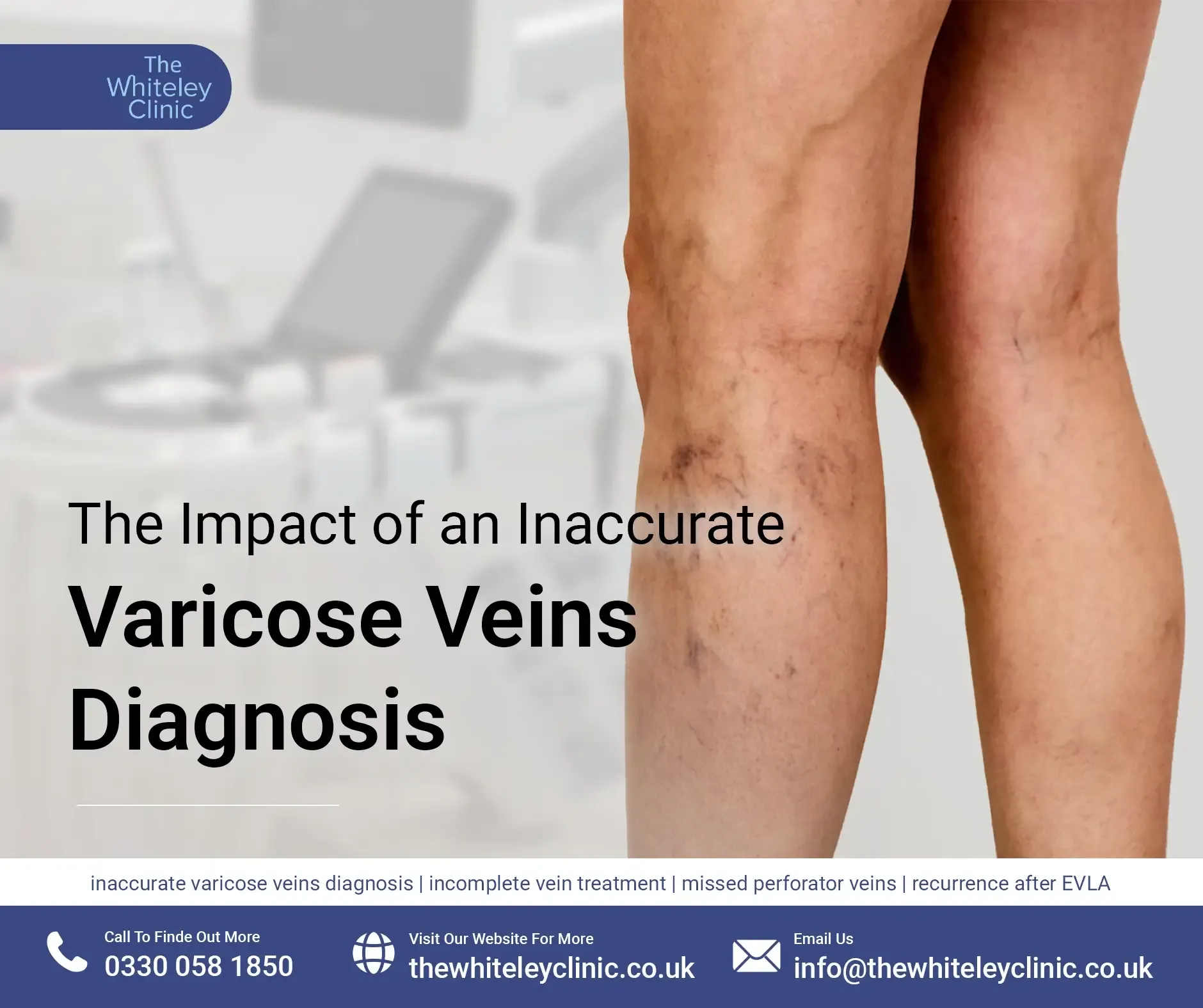 The Impact of an Inaccurate Varicose Veins Diagnosis