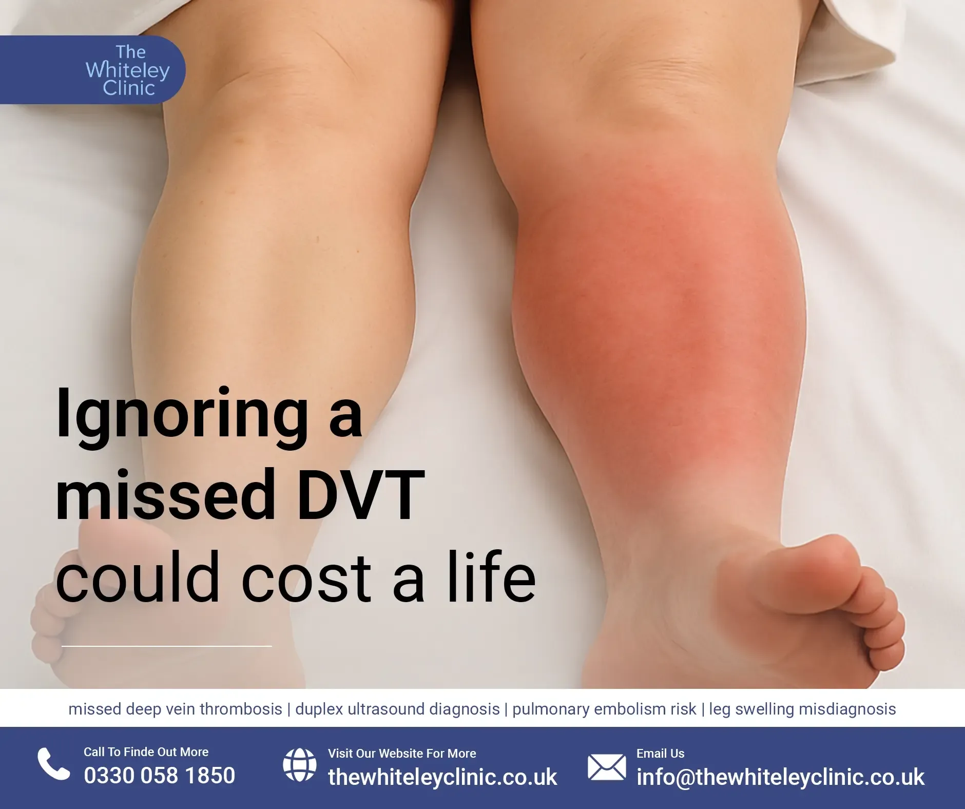 Ignoring a missed DVT could cost a life